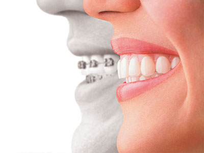 The image features a split-screen graphic with two different perspectives  on the left, an adult s smiling face, and on the right, a close-up of a person s teeth and mouth.