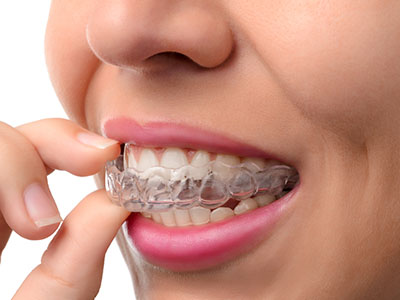 An adult female with a clear, straight smile is holding a transparent retainer in her hand.