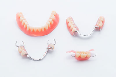 Alt text  The image displays a collection of dental implants with visible teeth and metal fixtures, presented against a white background.