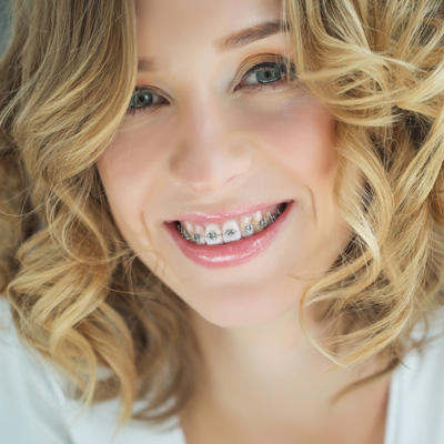 The image is a portrait of a smiling woman with braces, wearing a white top and curly hair.