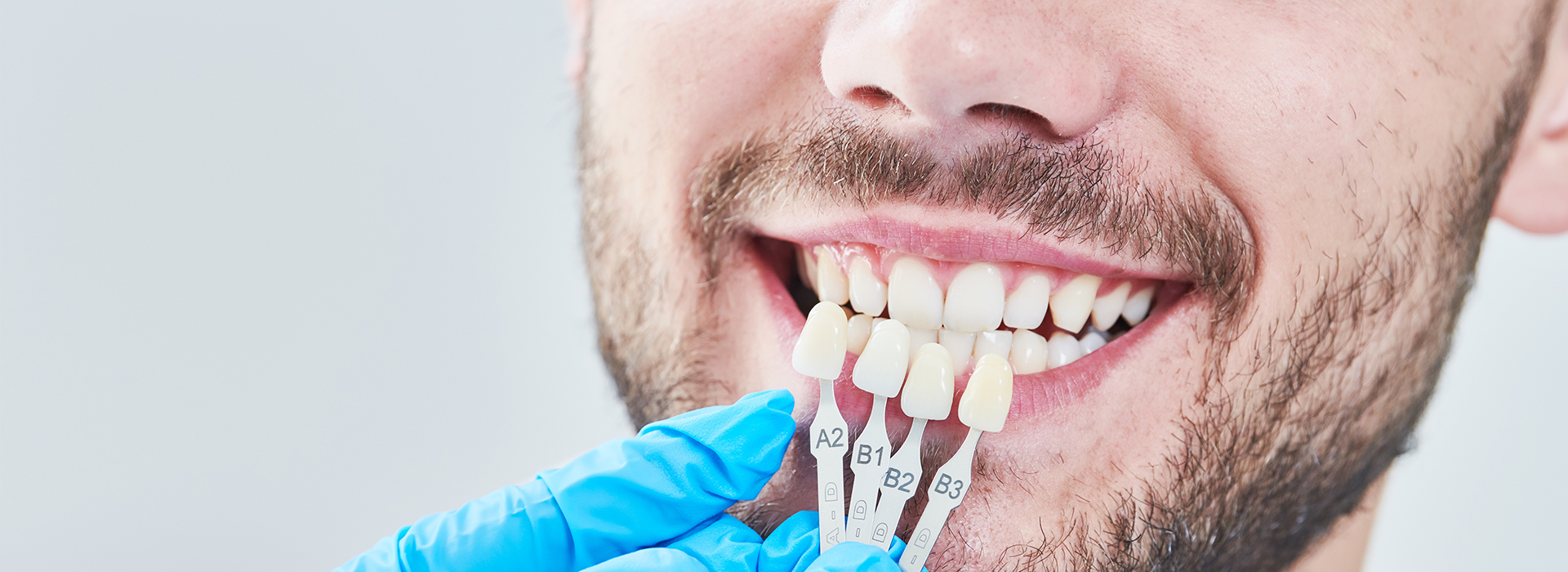 A man smiling with a dental implant being fitted into his mouth, showcasing the dental care service.