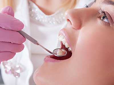 A woman receiving dental care, with a dental professional using a drill to clean her teeth.