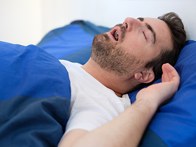 A man is lying in bed with his eyes closed, appearing to be asleep.